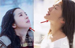 下颌骨明星,揭秘明星们的美丽秘密